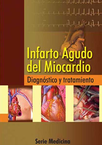 Infarto agudo del miocardio (Libro)