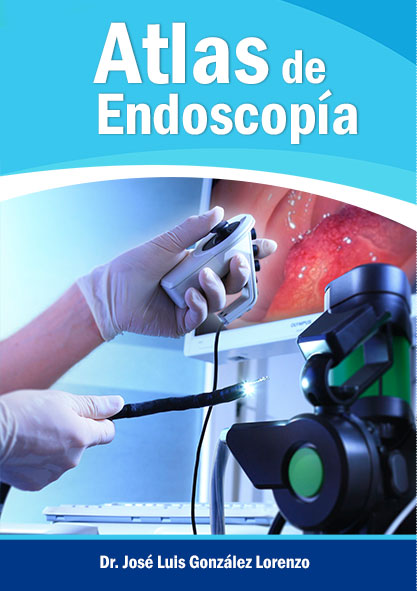 Atlas de endoscopía 1: Endoscopía (Libro)